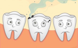 علاج تسوس الاسنان (1)