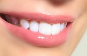 علاج تسوس الاسنان (4)